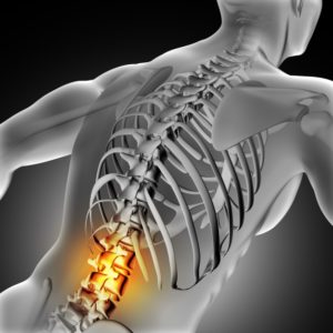 Spine Diagram & Physiotherapy 
