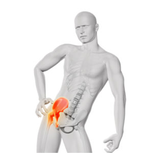 snapping hip syndrome diagram