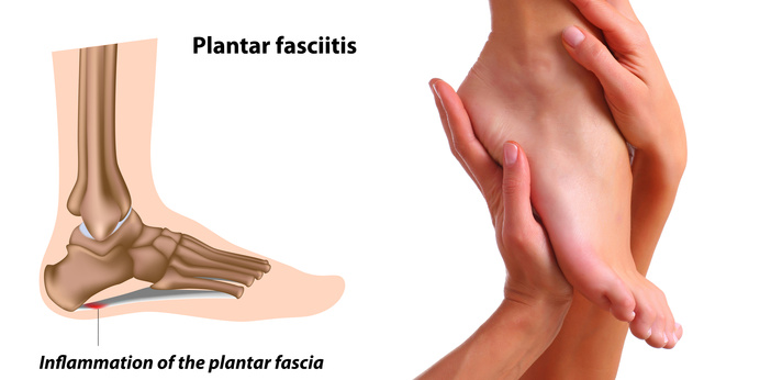 Relieve Heel Pain with these Steps